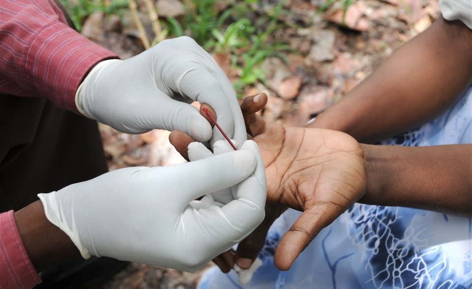 HIV Aids Testing