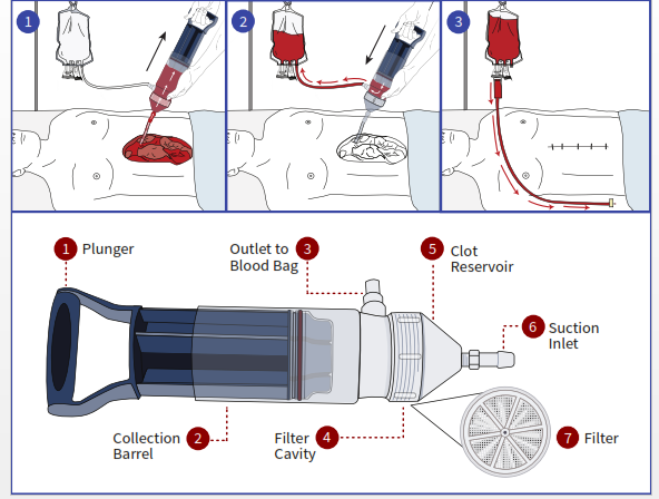 The Hemafuse device, and how it works. www.businesstoday.co.ke